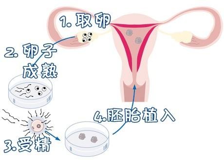 代生男孩包性别门诊